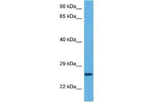 Host:  Rabbit  Target Name:  GSTA5  Sample Tissue:  Human Hela Whole Cell  Antibody Dilution:  1ug/ml (GSTa5 Antikörper  (Middle Region))
