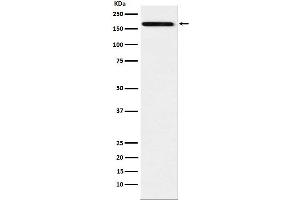 Western blot analysis of IL17A Receptor expression in Raji cell lysate.