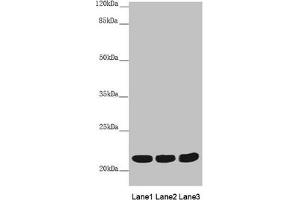 Western blot All lanes: MYL3 antibody at 3. (MYL3/CMLC1 Antikörper  (AA 1-195))
