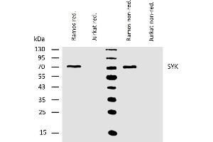 Western blotting analysis of human Syk using mouse monoclonal antibody SYK-01 on lysates of Ramos and Jurkat (negative control) cells under reducing and non-reducing conditions. (SYK Antikörper  (AA 5-360))