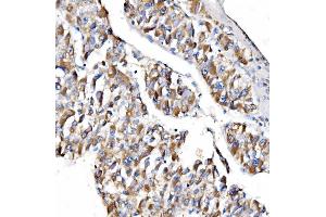 IHC analysis of NDUFAF1 using anti-NDUFAF1 antibody (ABIN7602459).