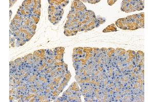 ABIN7094578 and ABIN7098627 at 1/100 staining Rat pancreatic tissue by IHC-P. (GLS2 Antikörper  (N-Term))