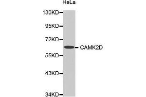 Western Blotting (WB) image for anti-Calcium/calmodulin-Dependent Protein Kinase II delta (CAMK2D) (AA 1-260) antibody (ABIN6213921) (CAMK2D Antikörper  (AA 1-260))