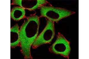 Fluorescent image of A549 cells stained with ALDH1A1 antibody at 1:25. (ALDH1A1 Antikörper  (AA 306-339))