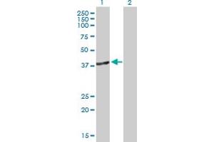 Western Blot analysis of DNMT3L expression in transfected 293T cell line by DNMT3L MaxPab polyclonal antibody. (DNMT3L Antikörper  (AA 1-386))