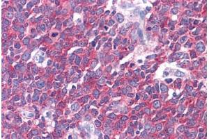 Human Tonsil: Formalin-Fixed, Paraffin-Embedded (FFPE) (LMTK2 Antikörper  (AA 1181-1280))