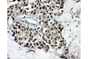 Immunohistochemical staining of paraffin-embedded thyroid tissue using anti-CAMK1Dmouse monoclonal antibody. (CAMK1D Antikörper)