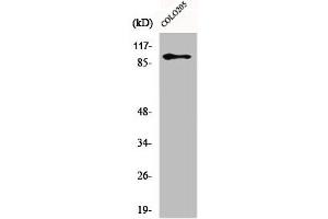 Western Blot analysis of Jurkat cells using DDX54 Polyclonal Antibody (DDX54 Antikörper  (Internal Region))