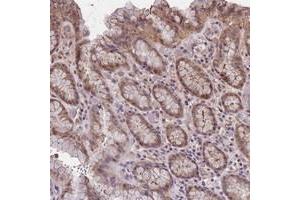 Immunohistochemical staining of human stomach with C9orf167 polyclonal antibody  shows moderate cytoplasmic positivity in glandular cells at 1:10-1:20 dilution. (TOR4A Antikörper)