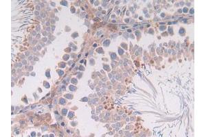 IHC-P analysis of Rat Intestine Tissue, with DAB staining. (IL-4 Antikörper  (AA 61-111))