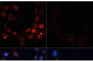 Immunofluorescence analysis of NIH/3T3 cells using Phospho-γH2A. (gamma H2AX Antikörper  (pSer139))
