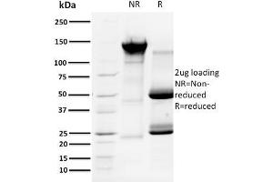 SDS-PAGE Analysis Purified Cyclin A1 Mouse Monoclonal Antibody (XLA1-3).