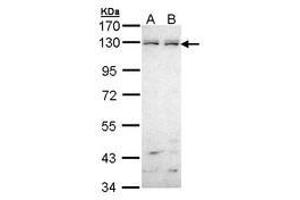 Image no. 1 for anti-EPH Receptor B6 (EPHB6) (AA 793-977) antibody (ABIN467545) (EPH Receptor B6 Antikörper  (AA 793-977))