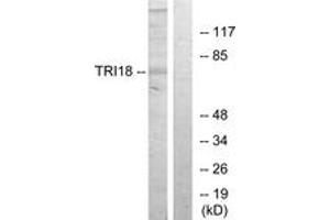 Western blot analysis of extracts from 293 cells, using TRI18 Antibody. (MID1 Antikörper  (AA 71-120))