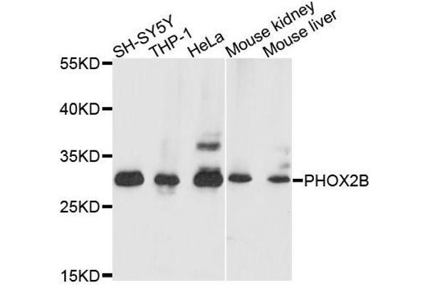 PHOX2B anticorps