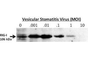 24-hour post infection immunoblots of whole cell lysates from primary murine microglia cells (2x106) untreated (0) or exposed to vesicular stomatitis virus at a range of viral particle/cell ratios. (DDX58 Antikörper  (C-Term))
