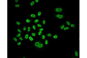 Immunofluorescence analysis of U2OS cells using MCM6 antibody. (MCM6 Antikörper)