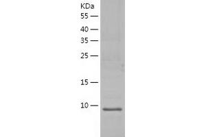 Western Blotting (WB) image for LSM2 Homolog, U6 Small Nuclear RNA Associated (LSM2) (AA 1-95) protein (His tag) (ABIN7289490) (LSM2 Protein (AA 1-95) (His tag))