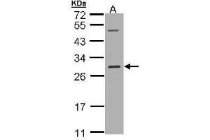 WB Image Sample (30 ug of whole cell lysate) A: Hep G2 , 12% SDS PAGE antibody diluted at 1:1000 (RALB Antikörper  (full length))