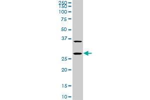 CITED1 monoclonal antibody (M04), clone 6E12. (CITED1 Antikörper  (AA 94-193))