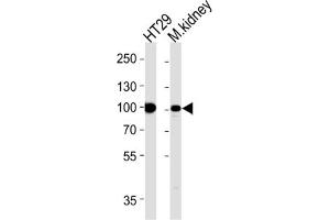 Western Blotting (WB) image for anti-Villin 1 (VIL1) antibody (ABIN5022700) (Villin 1 Antikörper)