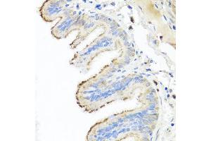 Immunohistochemistry of paraffin-embedded human trachea using IL10 antibody at dilution of 1:100 (x40 lens).