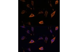 Immunofluorescence analysis of L929 cells using SEMA antibody (ABIN7270199) at dilution of 1:100. (Sema4a Antikörper  (AA 320-580))