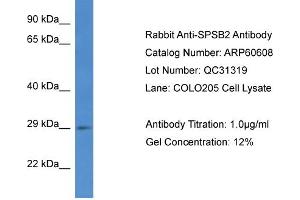 Western Blotting (WB) image for anti-SplA/ryanodine Receptor Domain and SOCS Box Containing 2 (SPSB2) (C-Term) antibody (ABIN786218) (SPSB2 Antikörper  (C-Term))