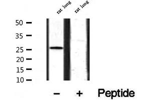 Western blot analysis of extracts from rat lung, using BCA3 Antibody. (AKIP1 Antikörper  (Internal Region))