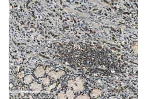 IHC analysis of PARP using anti-PARP antibody (ABIN7602278). (PARP1 Antikörper  (AA 670-858))