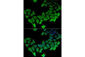 Immunofluorescence analysis of HeLa cells using APLP1 antibody (ABIN5975741). (APLP1 Antikörper)