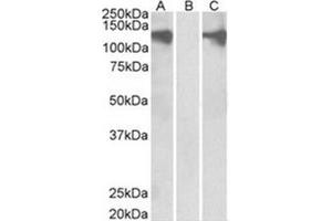 Image no. 1 for anti-Pumilio Homolog 2 (Drosophila) (PUM2) (Internal Region) antibody (ABIN374533) (PUM2 Antikörper  (Internal Region))