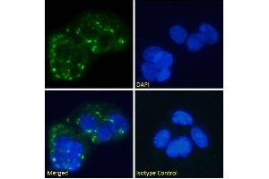 Immunofluorescence staining of fixed HepG2 cells with anti-Human Glucagon Receptor antibody hGR-2 F6. (Rekombinanter Glucagon Receptor Antikörper)