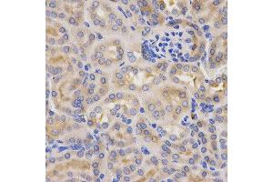 Immunohistochemistry of paraffin-embedded mouse kidney using CFB antibody at dilution of 1:200 (x400 lens) (Complement Factor B Antikörper)