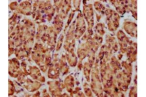 IHC image of ABIN7161327 diluted at 1:300 and staining in paraffin-embedded human pancreatic cancer performed on a Leica BondTM system. (NLN Antikörper  (AA 109-241))