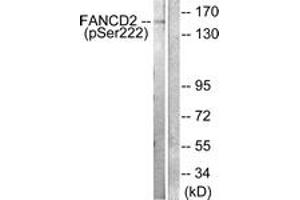 Western blot analysis of extracts from HT29 cells treated with Calyculin A 50ng/ml 30', using FANCD2 (Phospho-Ser222) Antibody. (FANCD2 Antikörper  (pSer222))