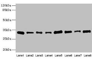Western blot All lanes: PLP1 antibody at 4 μg/mL Lane 1: Hela whole cell lysate Lane 2: HL60 whole cell lysate Lane 3: K562 whole cell lysate Lane 4: THP-1 whole cell lysate Lane 5: U937 whole cell lysate Lane 6: A549 whole cell lysate Lane 7: Caco-2 whole cell lysate Lane 8: HepG2 whole cell lysate Secondary Goat polyclonal to rabbit IgG at 1/10000 dilution Predicted band size: 31, 27 kDa Observed band size: 31 kDa (PLP1 Antikörper  (AA 143-197))
