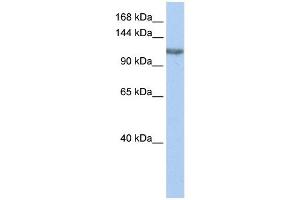 TGS1 antibody used at 1 ug/ml to detect target protein.