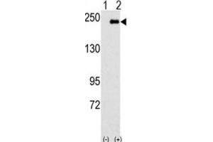 Western Blotting (WB) image for anti-Sperm Associated Antigen 9 (SPAG9) antibody (ABIN3003116) (SPAG9 Antikörper)