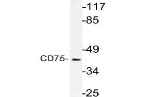 Western blot (WB) analysis of CD75 antibody in extracts from RAW264. (ST6GAL1 Antikörper)