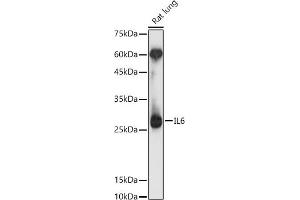 Western blot analysis of extracts of Rat lung, using IL6 antibody (ABIN1513075, ABIN1514222, ABIN1683697 and ABIN6213773) at 1:1000 dilution. (IL-6 Antikörper  (AA 30-212))