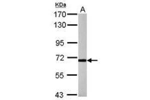 Image no. 1 for anti-Purinergic Receptor P2X, Ligand-Gated Ion Channel, 7 (P2RX7) (C-Term) antibody (ABIN1495909) (P2RX7 Antikörper  (C-Term))