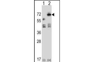 Western blot analysis of ARSF (arrow) using rabbit polyclonal ARSF Antibody (Center) (ABIN657171 and ABIN2846304). (ARSF Antikörper  (AA 236-264))