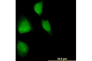 Immunofluorescence of monoclonal antibody to MAPKAPK2 on HeLa cell. (MAPKAP Kinase 2 Antikörper  (AA 266-352))
