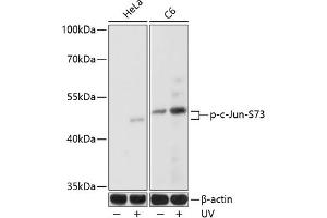 Western blot analysis of extracts of various cell lines, using Phospho-c-Jun-S73 antibody (ABIN3023567, ABIN3023568, ABIN3023569 and ABIN6225411) at 1:1000 dilution. (C-JUN Antikörper  (pSer73))