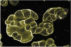Immunohistochemistry (IHC) image for anti-Cadherin 1, Type 1, E-Cadherin (Epithelial) (CDH1) (C-Term) antibody (ABIN967801) (E-cadherin Antikörper  (C-Term))