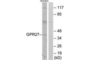 Western blot analysis of extracts from HuvEc cells, using GPR27 Antibody. (GPR27 Antikörper  (AA 181-230))