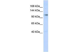 Western Blotting (WB) image for anti-Zinc Finger, MIZ-Type Containing 1 (ZMIZ1) (N-Term) antibody (ABIN2781101)