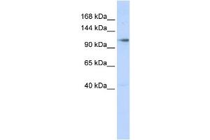WB Suggested Anti-ZMIZ1 Antibody Titration:  0.