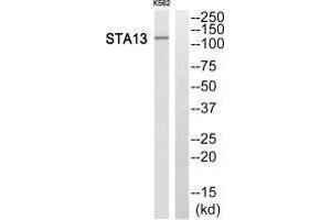 Western blot analysis of extracts from K562 cells, using STA13 antibody. (STARD13 Antikörper  (N-Term))